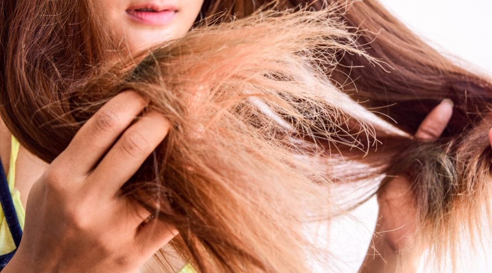 Cabelo Ressecado O Que Causas Como Identificar E Tratar Fala Universidades